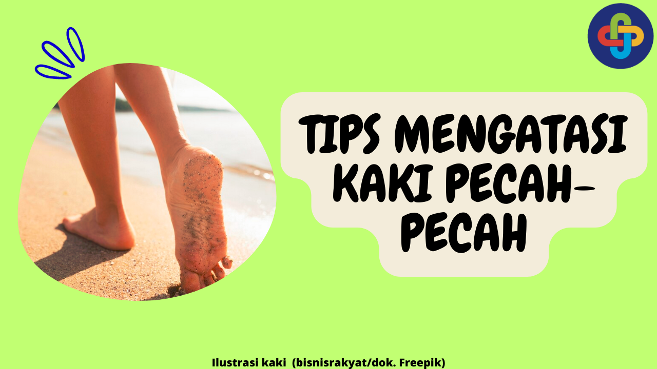 8 Tips Mengatasi Kaki Pecah-Pecah supaya Kulit Sehat dan Mulus